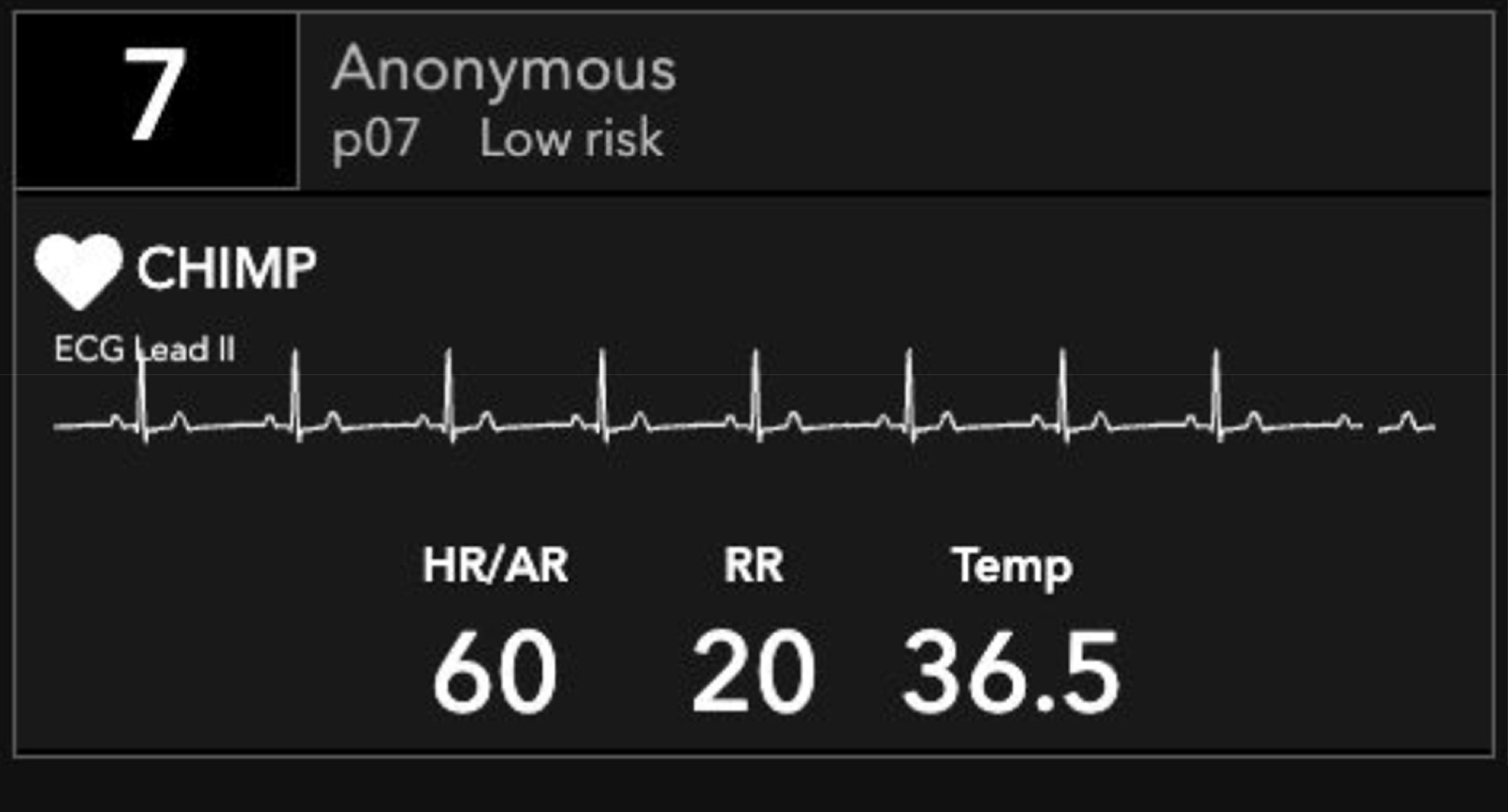 CHIMP Patient Detail interface with ECG, heart rate, respiratory rate and temperature